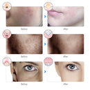 Máscara Facial LED Rejuvenescedora com 7 Cores